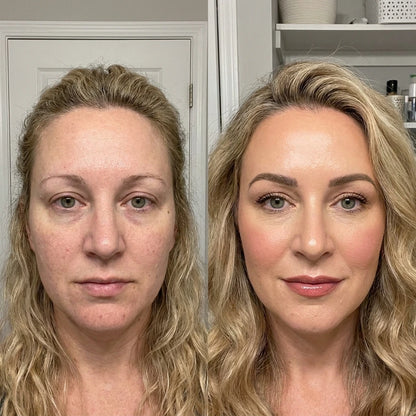 Daily Collagen Peptides