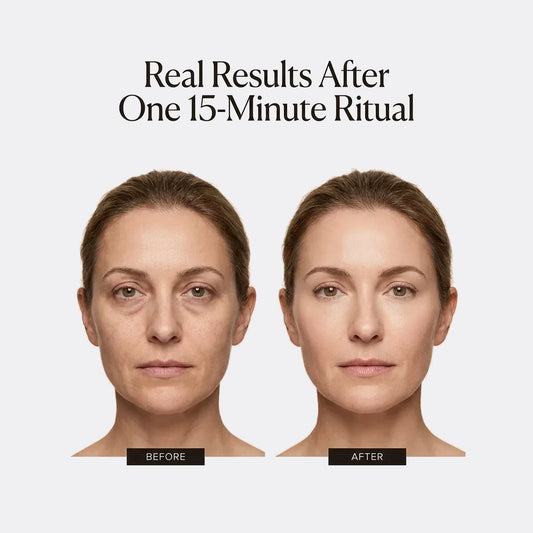 Collagen Under-Eye Patches